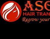 ASG_Hair_Transplant_Centre