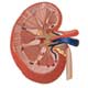 Acute Renal Failure