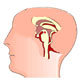 Birth Defect - Structural Defects