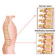 Ankylosing Spondylitis