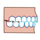 Bruxism / Tooth Grinding / Jaw Clenching / Teeth Clenching / Parasomnia