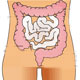 Colorectal Cancer/Colon and Rectal Cancer