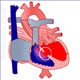 Congenital Heart Disease – Septal Defects