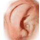 Otitis Media/ Middle Ear Infection