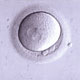 Egg Donation