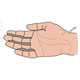 Ganglion Cysts - Ganglion Wrist