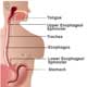 Reflux Esophagitis