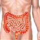 Ulcerative Colitis