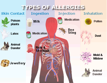 Allergy