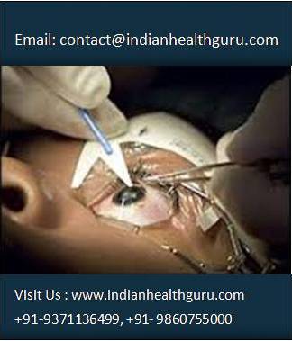 Experience Eye Surgery in India for a Brighter Vision