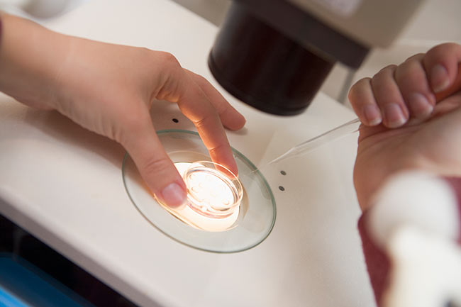 IVF Treatment