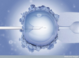 IVF Treatment and Procedure