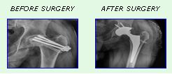 Knee Surgery