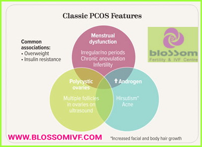 Learn what is PCOS