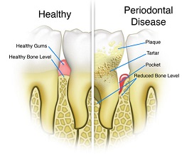 Periodontics