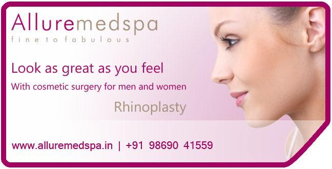Rhinoplasty - Woman | Before and After. very well done