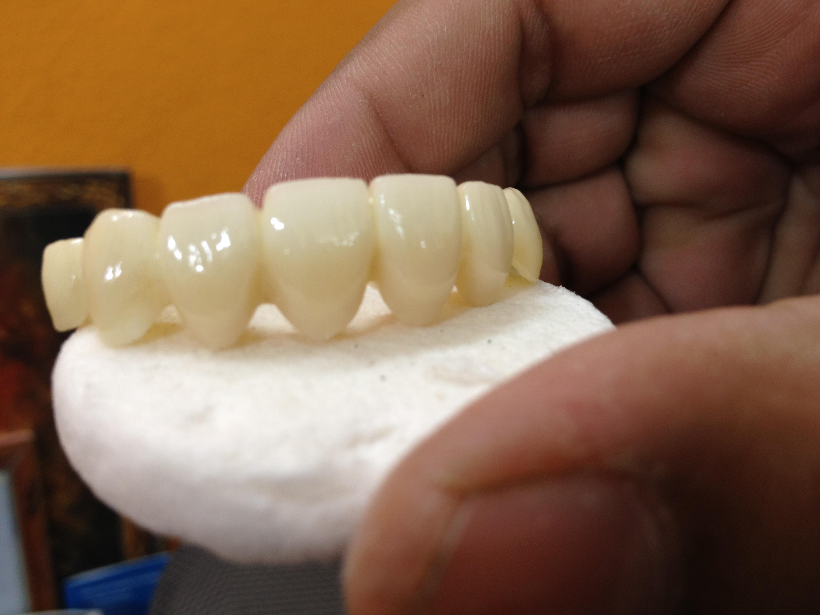 Aurobindo dental hospital hyderabad,